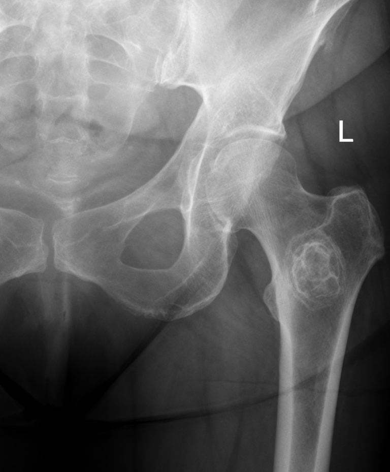 Guidelines British Orthopaedic Oncology Society
